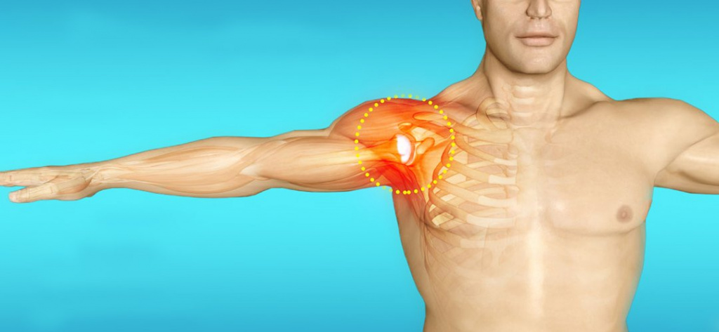 артрит плеча
